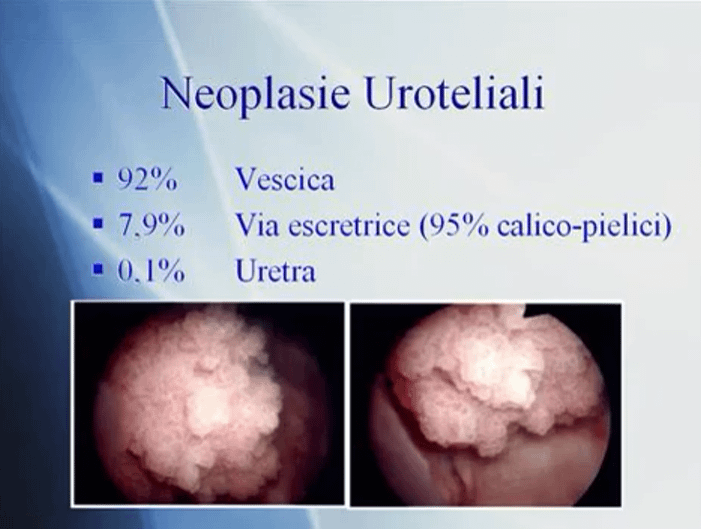 neoplasieurotel